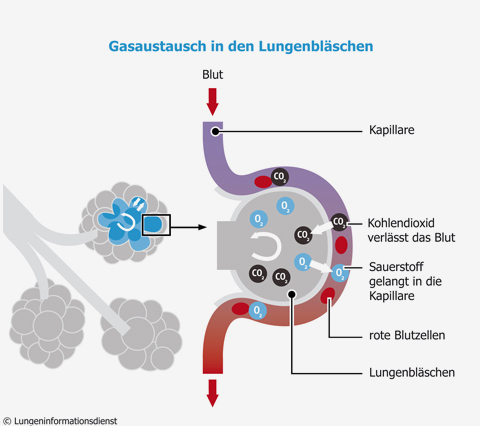 Gasaustausch Lungenbläschen; Quelle: Lungeninformationsdienst