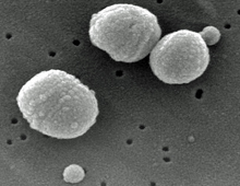 Streptococcus pneumoniae, Hauptverursacher der Lungenentzündung