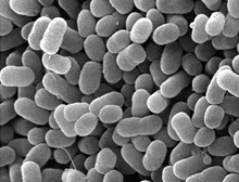 Topographical images of colonies of E. coli O157:H7 strains, © USDA (Pina Fratamico Microbiologist/Lead Scientist)