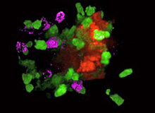 Eine seneszente Leberzelle (orange) ist dabei abzusterben, weil sie von verschiedenen Immunzellen (grün und violett) attackiert wurde.