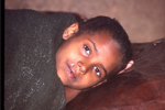 Young malaria patient near Alem Kitmama, Ethiopia, copyright: WHO/P. Virot