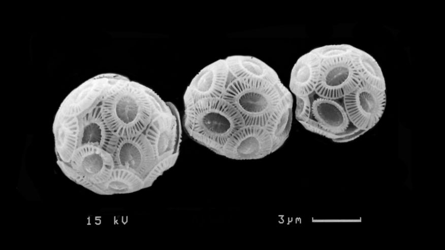 Eine Zelle der Kalkalge Emiliania huxleyi war der Ausgang des Forschungsexperiments