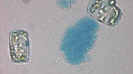 Schneefall im Meer – die Tiefsee als Lagerstätte für CO2?