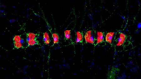 Kieselalge mit Fucose