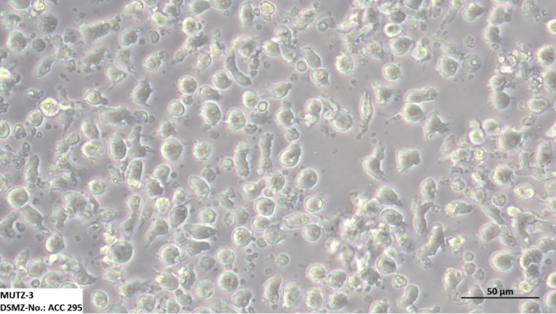 Aufnahme von Leukämiezellen unterm Mikroskop.
