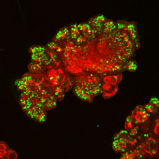Mikroskopische Aufnahme von einem menschlichen Darm-Organoid.
