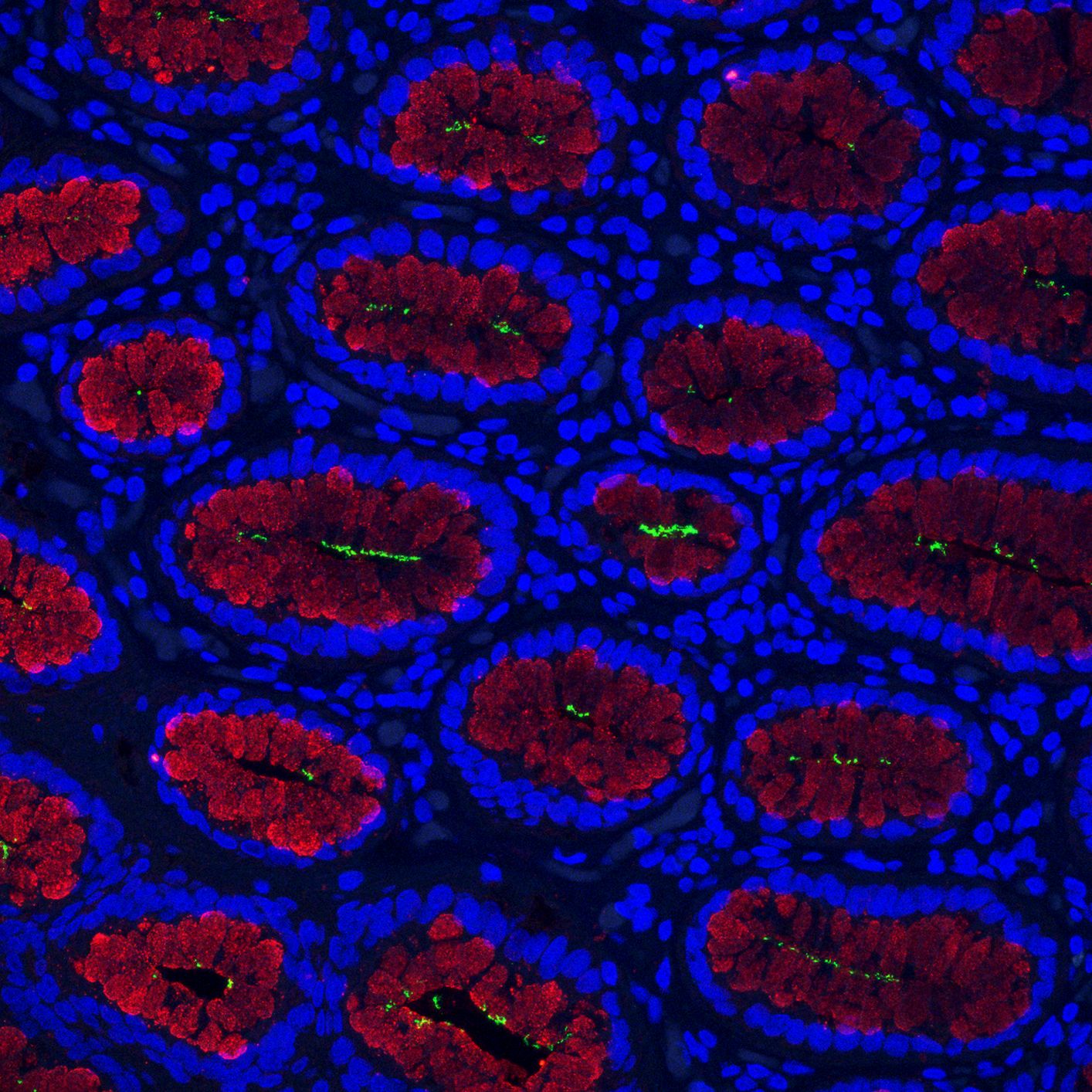 Mikroskopische Aufnahme von einem Gewebsschnitt von einem menschlichen Magen.