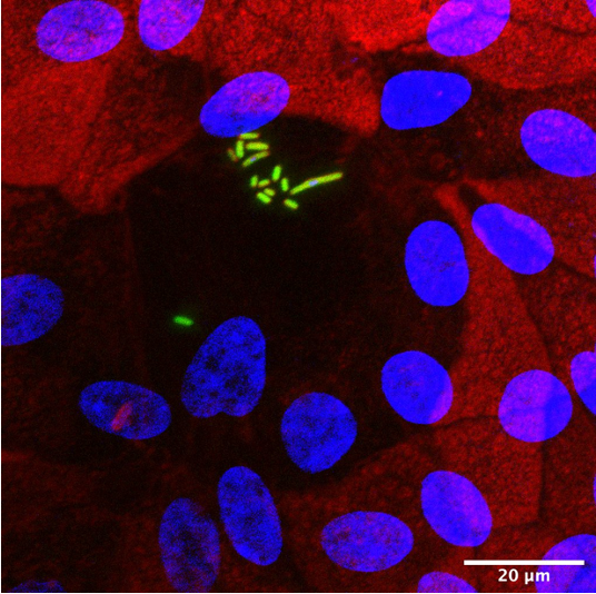 Mikroskopische Aufnahme von Zellen aus einem menschlichen Darm-Organoid, die experimentell mit Enteropathogenen Escherichia coli (EPEC) infiziert wurden. Blau markierte Zellkernen, Rot markiert das Zellskelett (Aktin) und grün EPEC. 