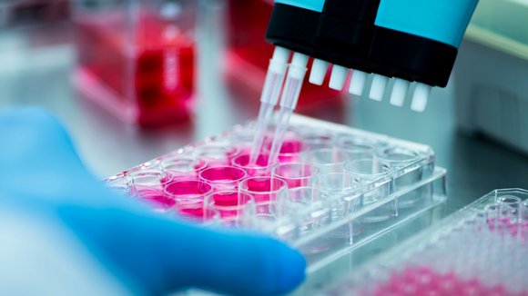 Eine Maschine füllt Reagenzgläser in einem Medizinlabor mit einer rosafarbenen Flüssigkeit.