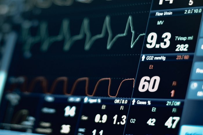Nahaufnahme eines Monitors mit Vitaldaten.