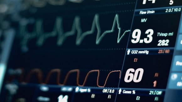 Nahaufnahme eines Monitors mit Vitaldaten.