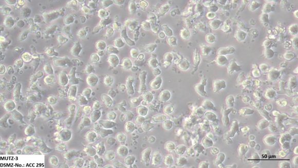 Aufnahme von Leukämiezellen unterm Mikroskop.