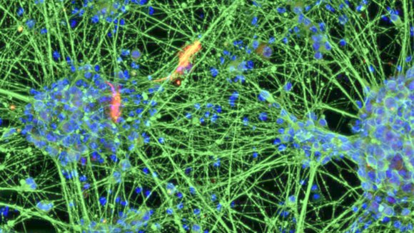 Nervenzellen, erzeugt durch Differenzierung von aus dem Blut gewonnenen induzierten neuralen Stammzellen