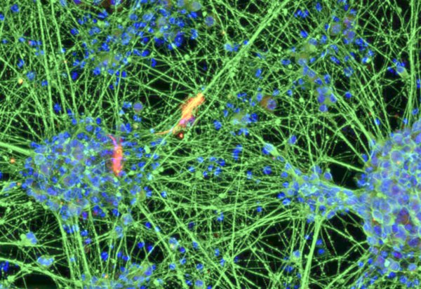 Nervenzellen, erzeugt durch Differenzierung von aus dem Blut gewonnenen induzierten neuralen Stammzellen